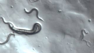 C Elegans under Microscope [upl. by Ayt]