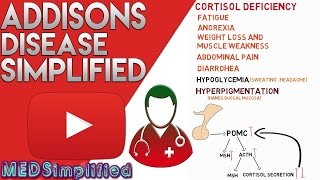 Addisons Disease Made Simple  Primary Adrenal Faliure [upl. by Atiral]