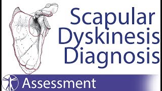 Diagnosing Scapula Dyskinesia [upl. by Stark]