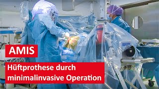 Hüftprothese durch minimalinvasive AMIS Methode  Live Operation [upl. by Ecnarrat936]