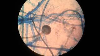 Rhizopus [upl. by Laith134]