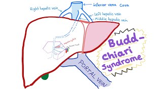 Subphrenic and Subhepatic Spaces and Hepatorenal Recess [upl. by Tserrof]