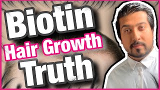 Biotin Hair Growth Truth Revealed  Is Biotin Good for Hair Growth 💇‍♂️ [upl. by Baryram427]