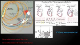 Hemodynamic Monitoring Part 1 [upl. by Falzetta459]