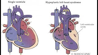 Syndrome hépatorénal  Docteur Synapse [upl. by Laehcym]